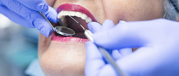 Best Emergency Wisdom Teeth Removal in New Market, AL
